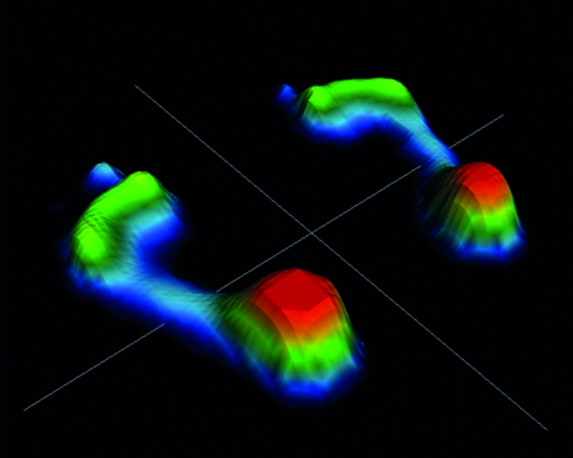 estudios-baropodometricos