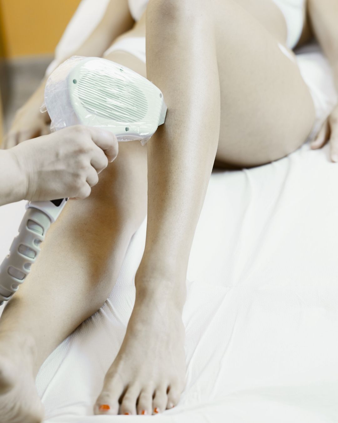 Depilación definitiva (2)